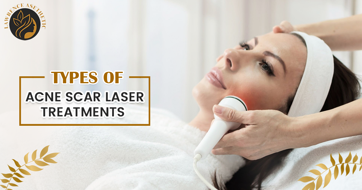 Type of Acne Scar Laser Treatment