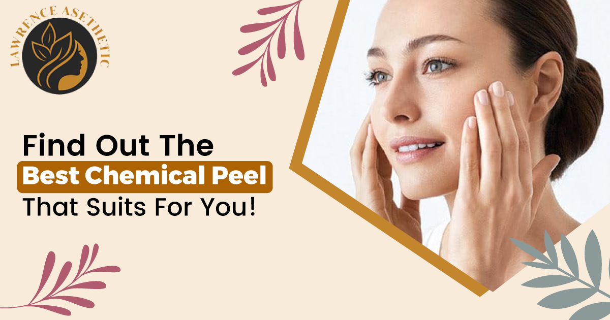 Find Out The Best Chemical Peel That Suits For You!